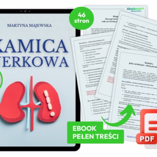 Kamienie w przewodzie moczowym, kamienie nerkowe