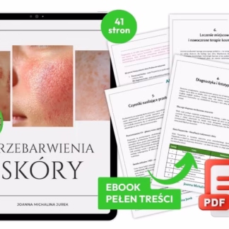 plamy na skórze, przebarwienia skóry